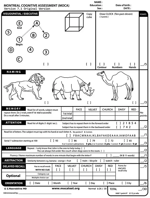 joe biden, dementia test, america news, world news, donald trump, interesting news, US president election 2024,