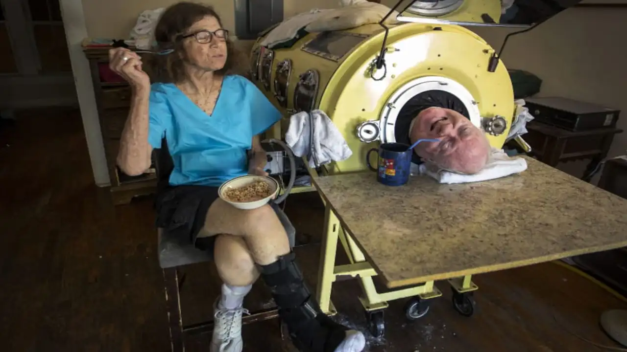 Paul Alexander Iron Lung Alive Technology