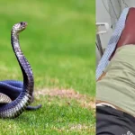 Snake Bite Case UP Vikas Dwivedi