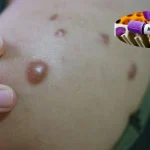 Monkeypox Symptoms and Prevention, MONKEYPOX TREATMENT, RAJASTHAN ON ALERT AFTER MPOX CASES, MPOX CASES IN INDIA, MONKEYPOX VIRUS, MonkeyPoxOutbreak, ViralMonkeyPox, PoxPrevention, MonkeyPoxAwareness, PoxProtection, PoxSymptoms, PoxTreatment, PoxPrecautions