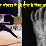 Neeraj Chopra Broken Hand In Diamond League