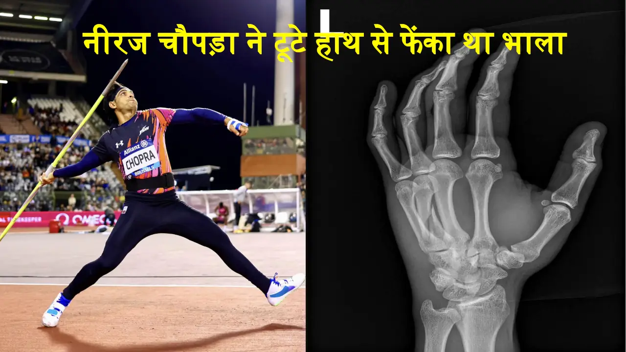 Neeraj Chopra Broken Hand In Diamond League